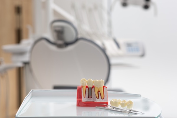Signs You Might Need Dental Implants Sooner Than You Think