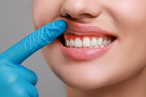 Benefits Of Gum Disease Treatment From A Dentist